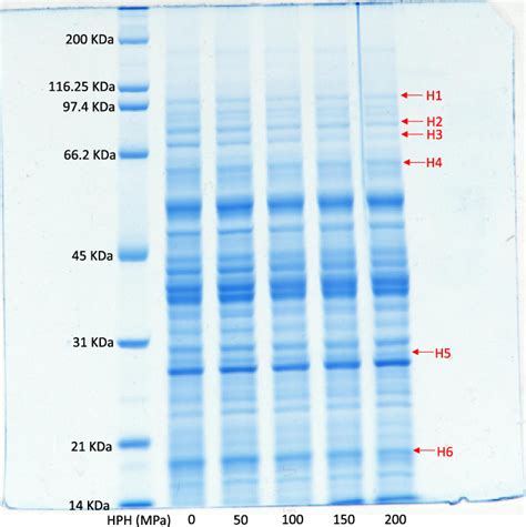 how to read sds page gel|Visualization of proteins in SDS.